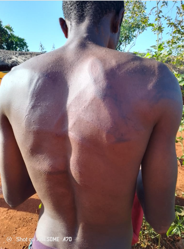 CDH VICAR Condemns Violent Forced Expulsions of Burundian Refugees in Nyarugusu Camp